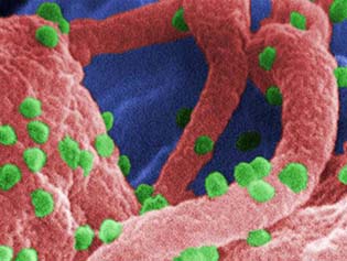 http://exame.abril.com.br/tecnologia/noticias/cientistas-britanicos-podem-ter-encontrado-a-cura-para-o-hiv